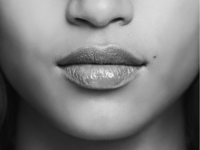 Docteur Maxime Cowen Chirurgien Esthetique Marseille LEVRES Docteur Maxime Cowen Chirurgien Esthetique Marseille LEVRES