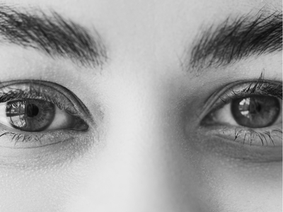 Docteur Maxime Cowen Chirurgien Esthetique Marseille Cernes Docteur Maxime Cowen Chirurgien Esthetique Marseille Cernes