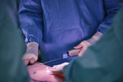 High Definition Liposuction In The Operating Room