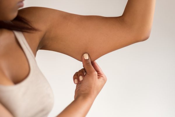 Young Woman Holding Excess Fat On Her Arm